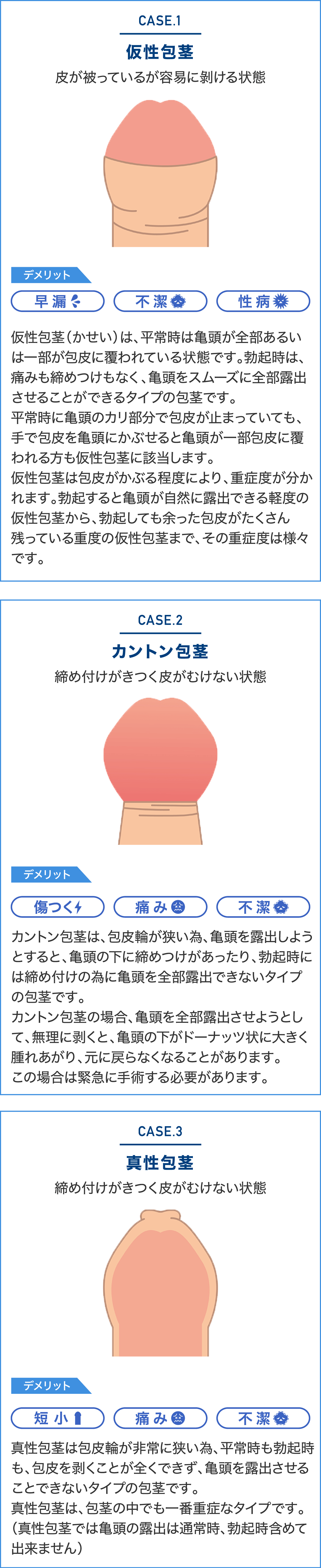 包茎とは？